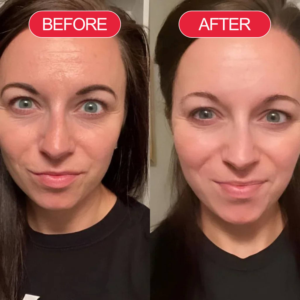 Koriderm™ Cream Time Reverse