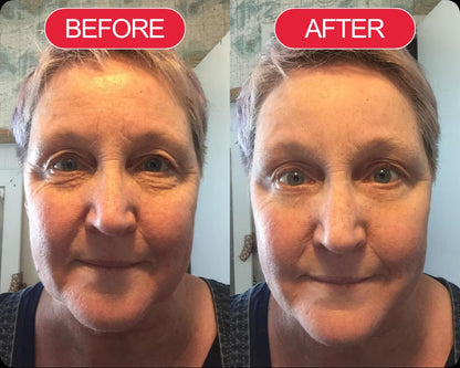 Koriderm™ Cream Time Reverse