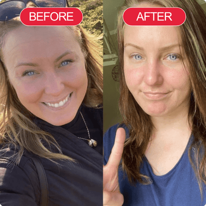 Koriderm™ Cream Time Reverse