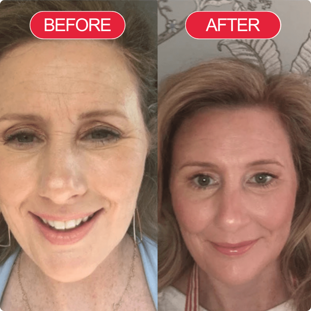 Koriderm™ Cream Time Reverse