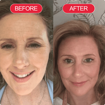 Koriderm™ Cream Time Reverse