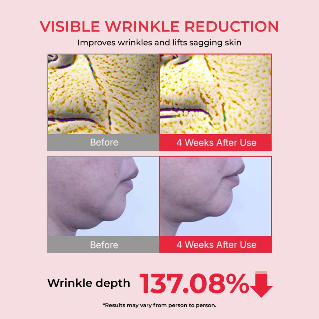 Koriderm™ Cream Time Reverse